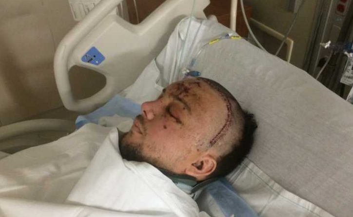 Vajon az én hibám volt?” – írta le. Elfutottam az édesanyjáért. „Mindenki más jól van?”: A férj csodálatos felépülést mutat autóbaleset és hónapokig tartó intenzív osztályos kezelés után, „teljesen elérzékenyült” az esküvőjén