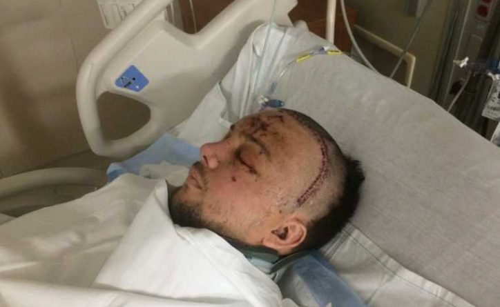 Vajon az én hibám volt?” – írta le. Elfutottam az édesanyjáért. „Mindenki más jól van?”: A férj csodálatos felépülést mutat autóbaleset és hónapokig tartó intenzív osztályos kezelés után, „teljesen elérzékenyült” az esküvőjén